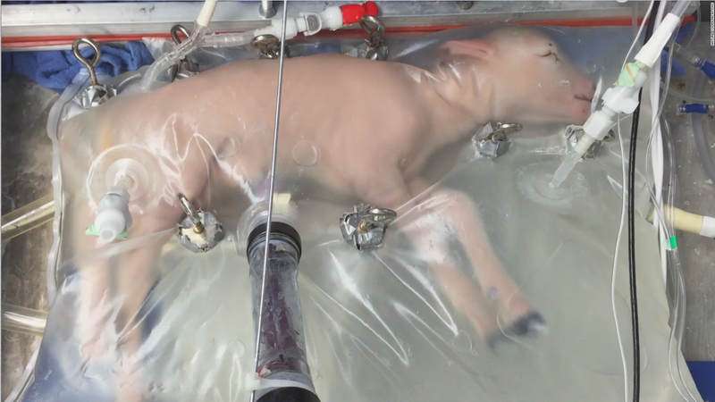 A lamb in an artificial womb from a team at the Children’s Hospital of Philadelphia. (Image: The Children’s Hospital of Philadelphia)